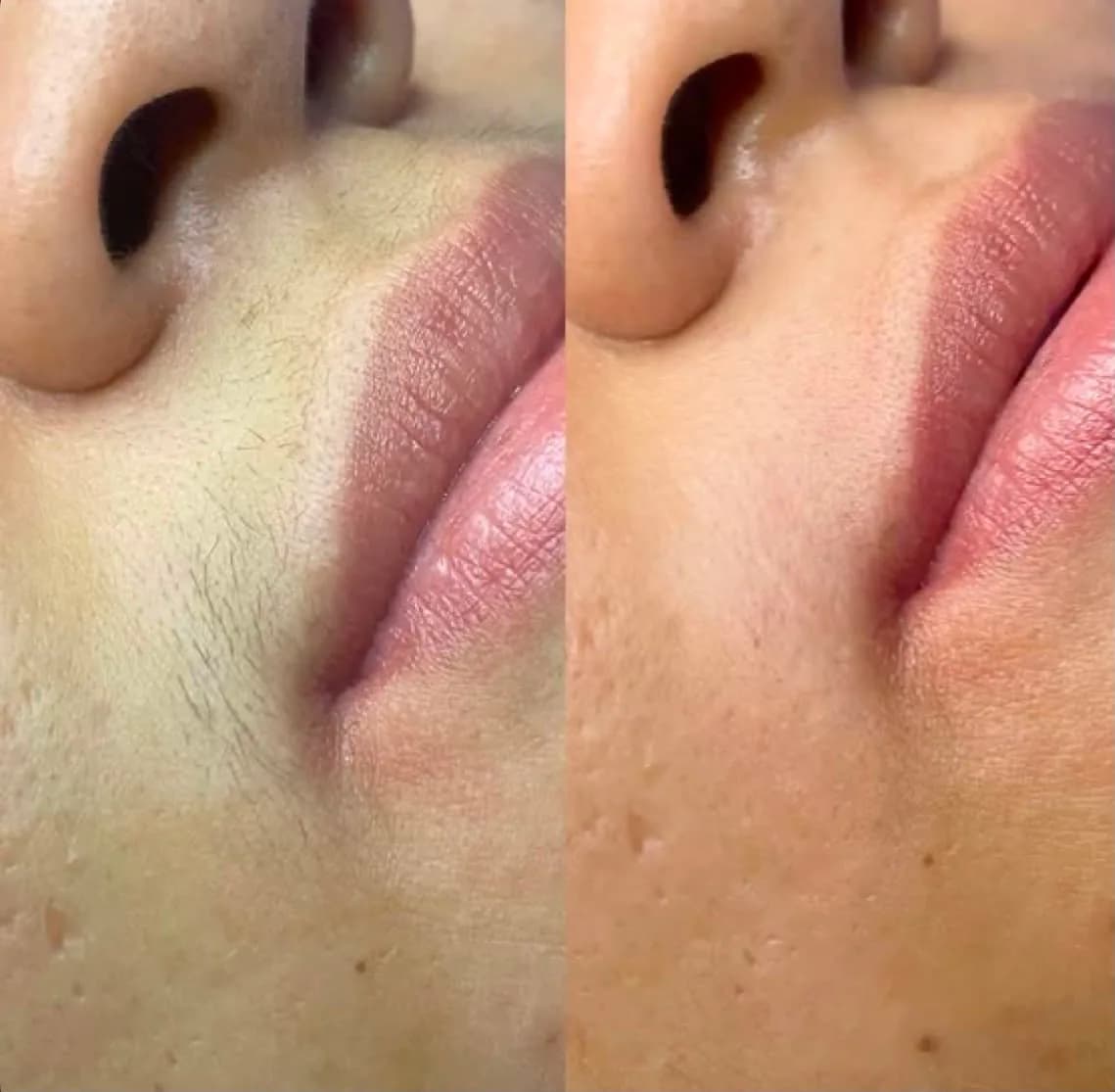 Depilação de Buço — Studio Rebeca Montanari, Barra Velha SC